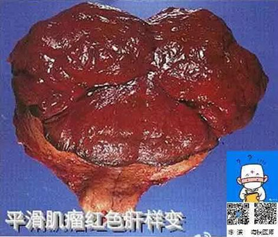 在供卵试管婴儿期间，女性的正常卵泡数量是多少？是不是越多越好