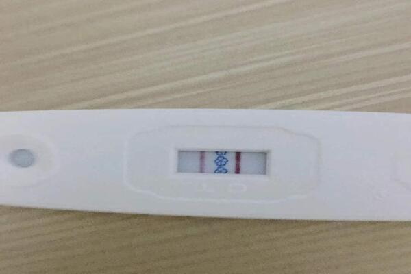 武汉试管婴儿可以报销医保吗