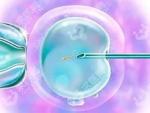 49岁国外做试管代怀产子吗,对身体有何要求？