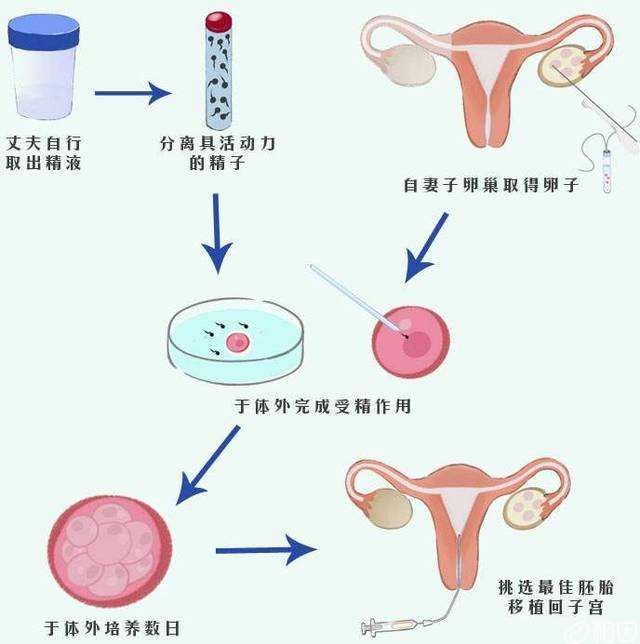 武汉二代女子试管代怀孕包生男孩费用大概多少钱？附武汉二代代怀